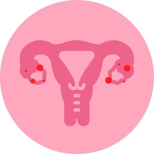 icono de endometriosis