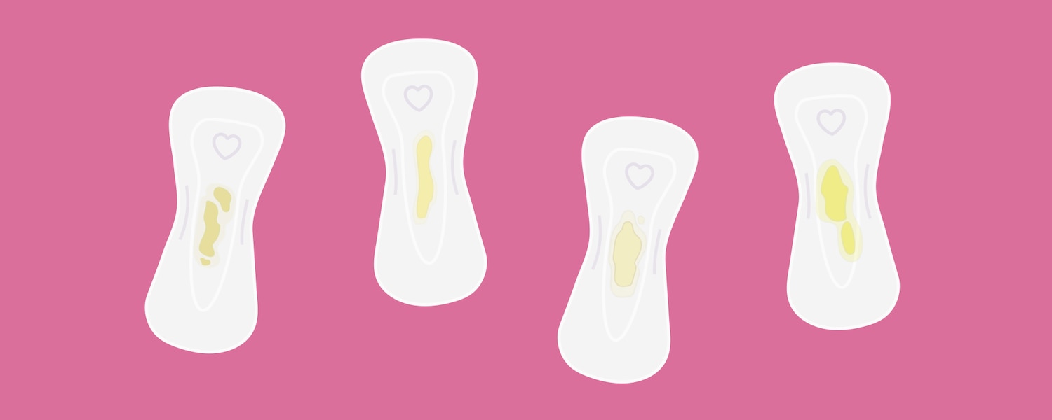 Múltiples protectores colocados uno al lado del otro, comparando diferentes tipos y texturas de flujo vaginal amarillo.
