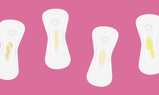 Múltiples protectores colocados uno al lado del otro, comparando diferentes tipos y texturas de flujo vaginal amarillo.