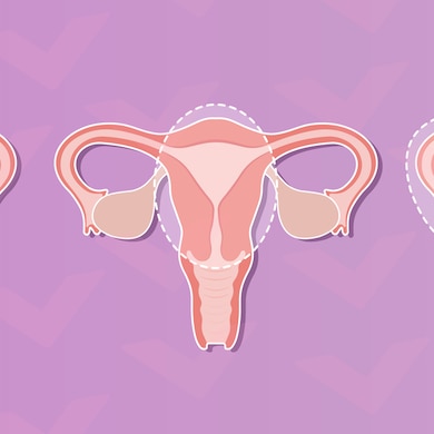 What Is A Hysterectomy