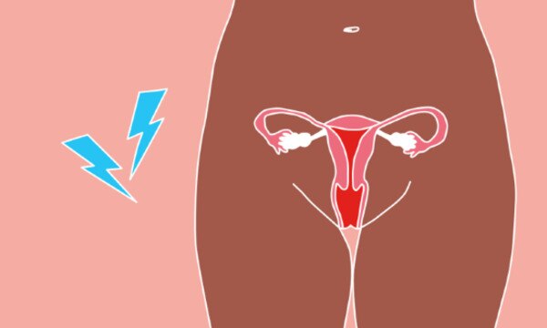 Article Gallery Dr Jane Endometriosis Desktop Wide