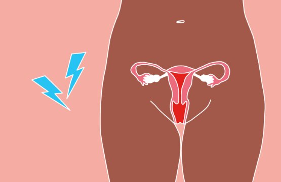 Article Gallery Dr Jane Endometriosis Desktop Wide