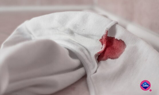 Spotting During Periods X