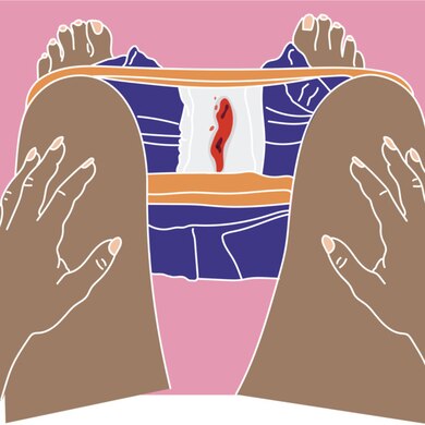 Miscarriage