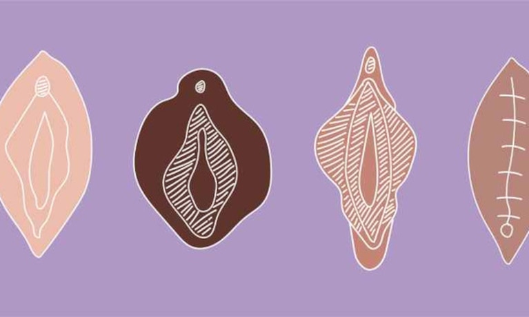 Fgm