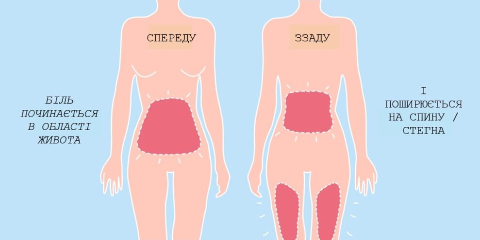 Illustration of where period pain can occur