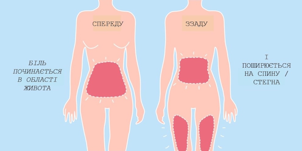 Illustration of where period pain can occur
