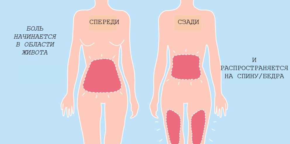 Illustration of where period pain can occur