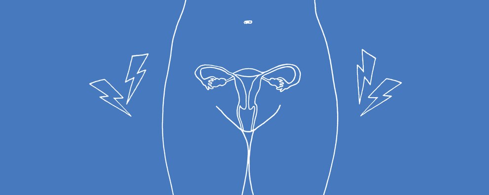 1500x600 Endometriosis