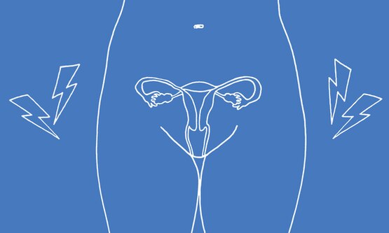 White illustration of endometriosis on a blue background - Libresse