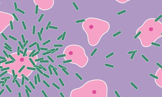Bacterial Vaginosis