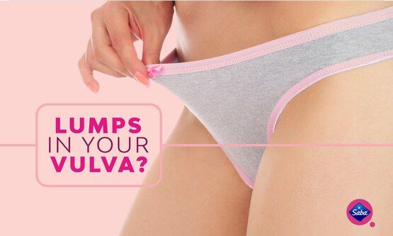Lumps In Your Vulva