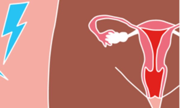 Article Gallery Dr Jane Endometriosis