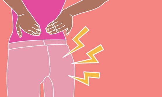 Fulmini in uscita dal sedere di una donna a indicare che soffre di proctalgia fugace, un dolore acuto e lancinante che interessa la zona rettale e che provoca fitte al sedere durante il ciclo