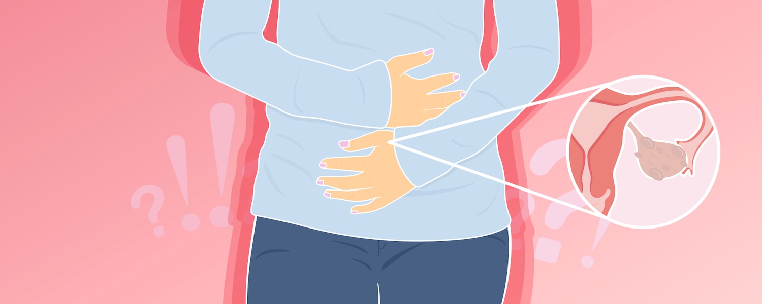Person holding their midsection with a close up of polycystic ovaries.