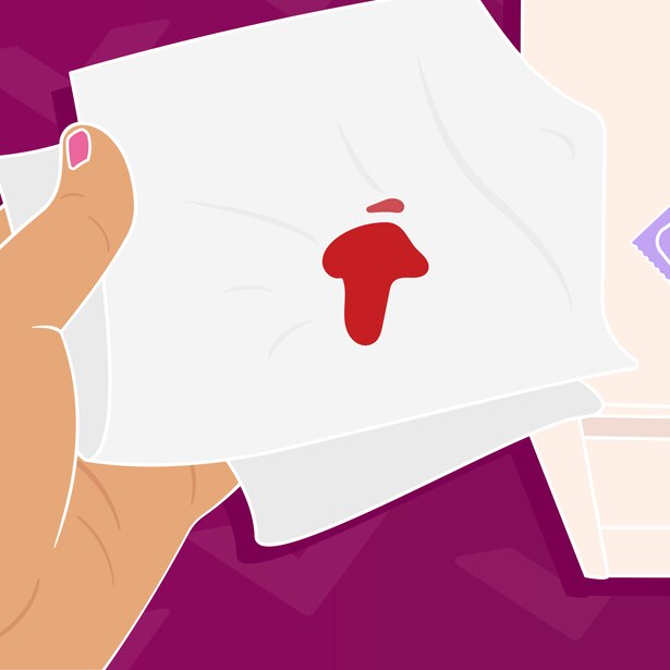 Bleeding After Sex Is It Normal