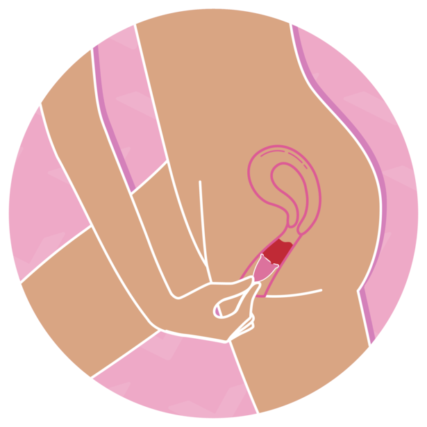 A person checking if a menstrual cup has opened after insertion