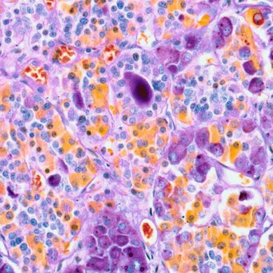 1500x600 Hormone Micrograph