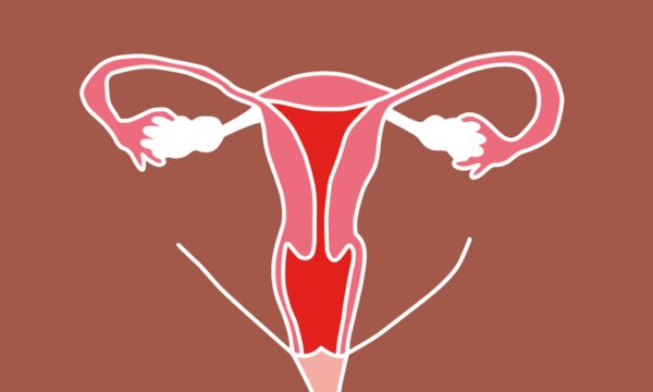 Endometriose verhalen