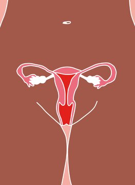 Article Gallery Endometriosis Desktop