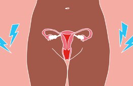 Article Gallery Endometriosis Mobile